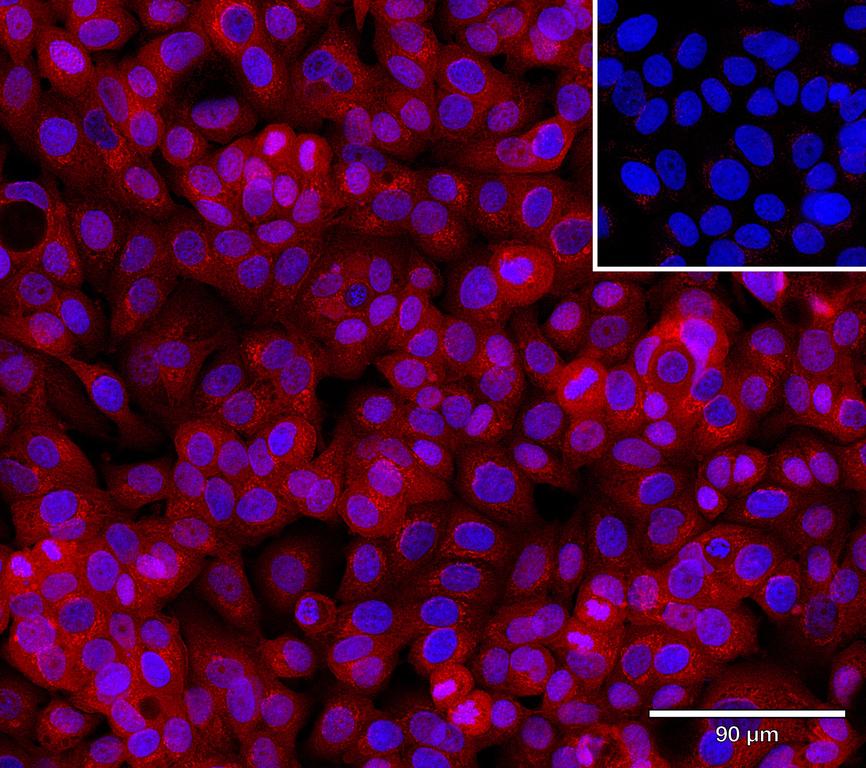 Ankyron PGS2_HUMAN Clone AH50221