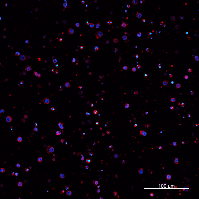 Ankyron PIG_IgG1 Clone AZ40818