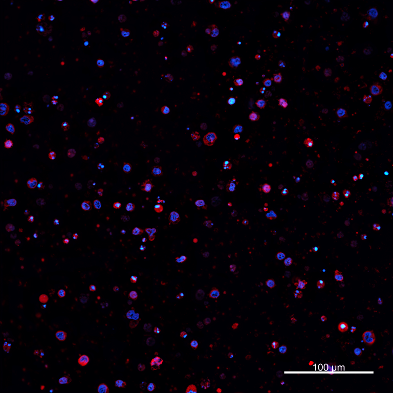 Ankyron PIG_IgG1 Clone AZ40819