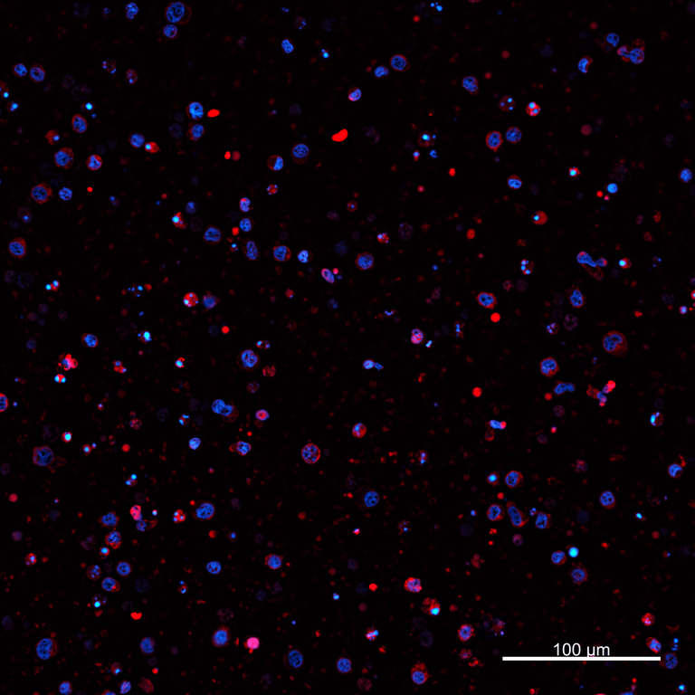 Ankyron PIG_IgG1 Clone AZ40820