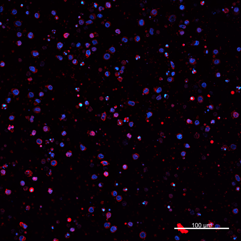 Ankyron PIG_IgG1 Clone AZ40814