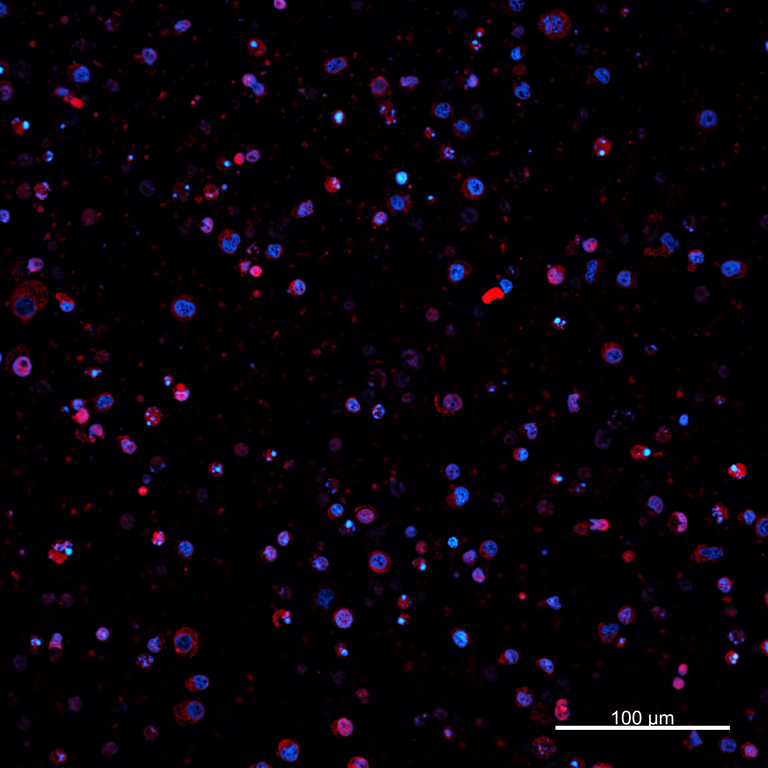 Ankyron PIG_IgG1 Clone AZ40815