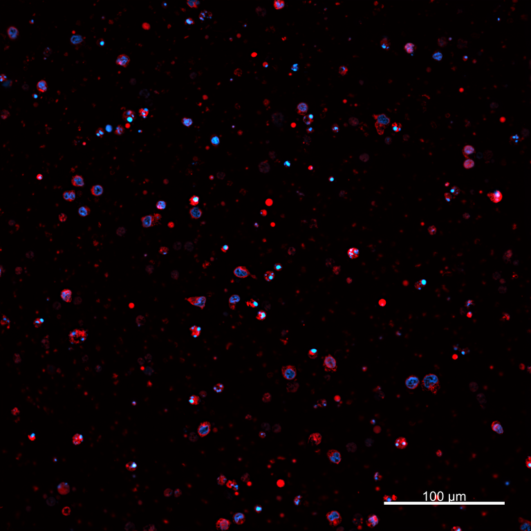 Ankyron PIG_IgG2a Clone AZ40677