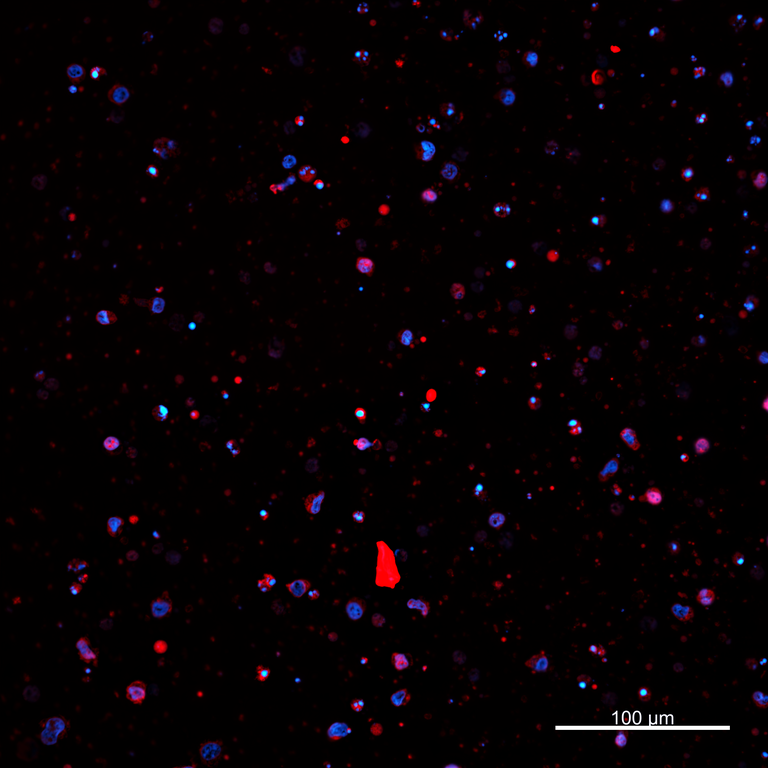 Ankyron PIG_IgG2a Clone AZ40679
