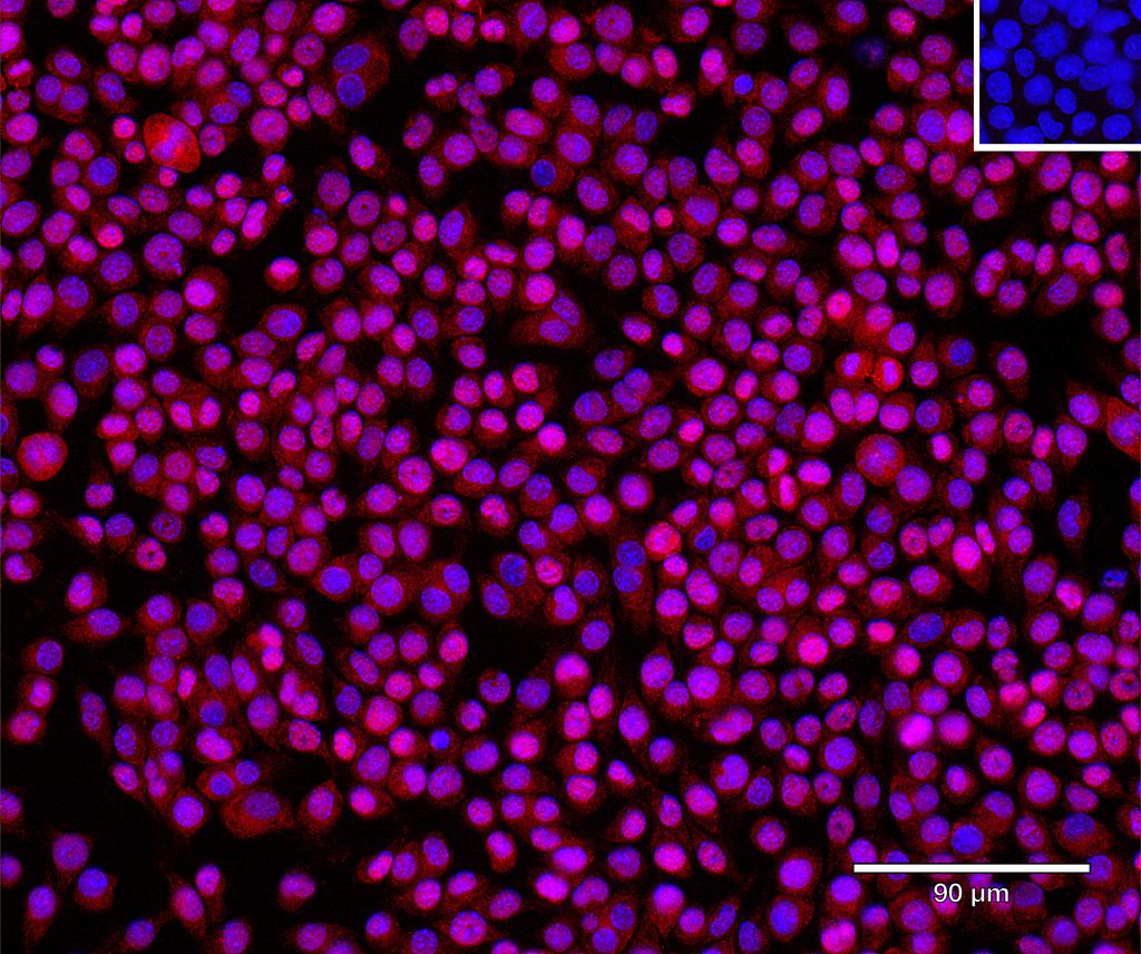 Ankyron PPA5_MOUSE Clone FE40669