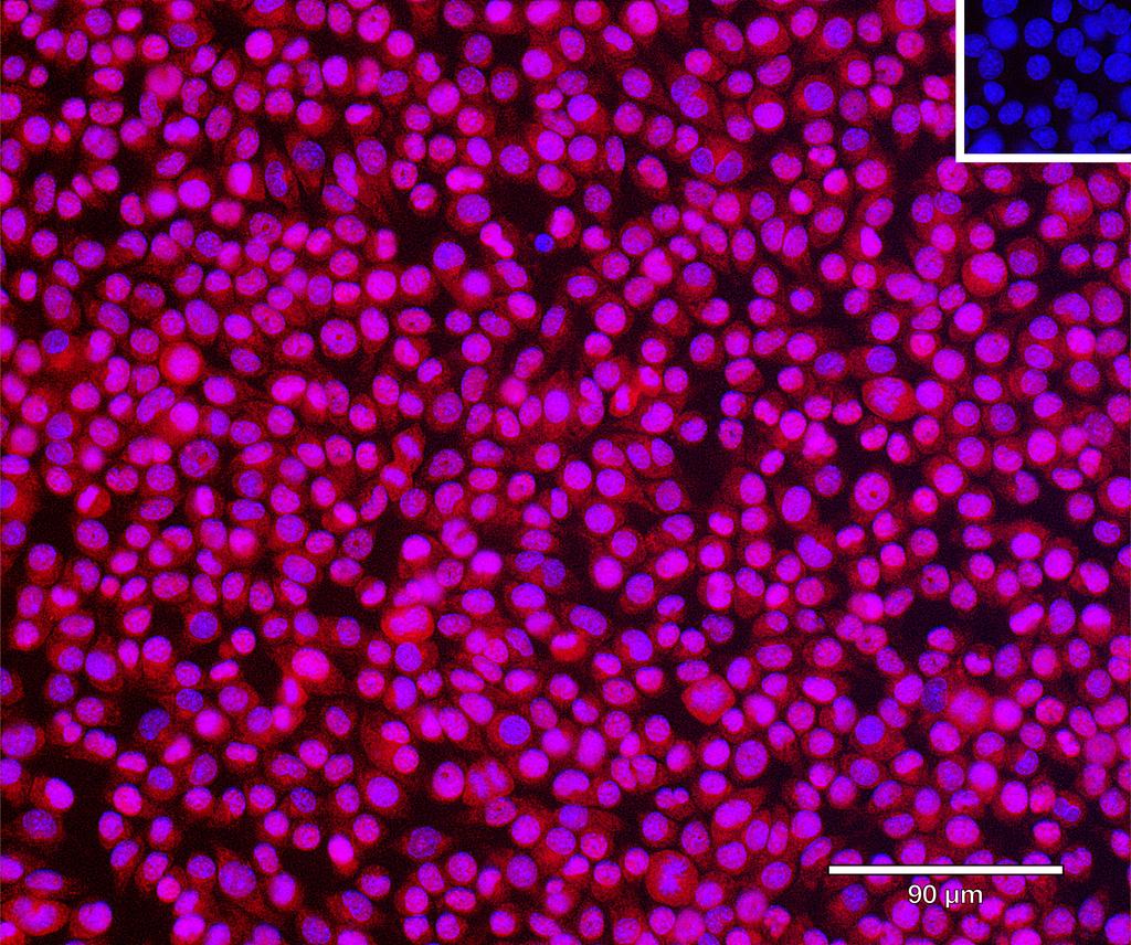 Ankyron PPA5_MOUSE Clone FE40670