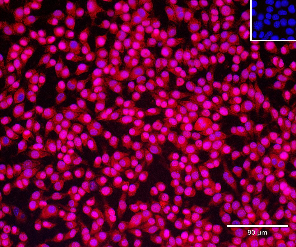 Ankyron PPA5_MOUSE Clone FE40673