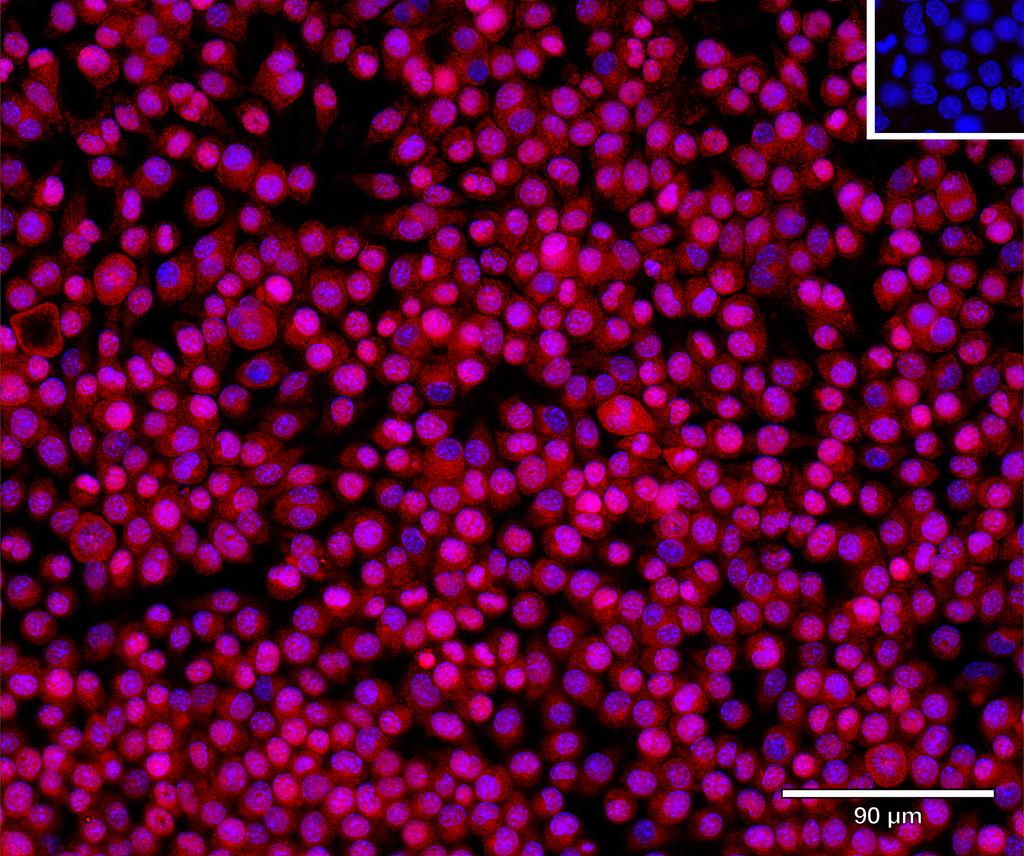 Ankyron PPA5_MOUSE Clone FE40674