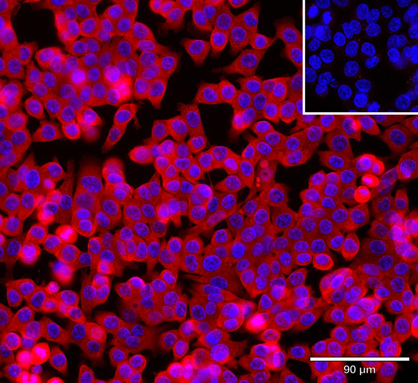 Ankyron PPBI_HUMAN Clone AR40409