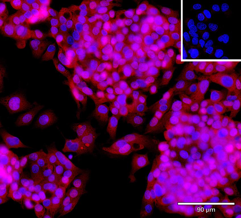 Ankyron PRELP_HUMAN Clone AZ40739