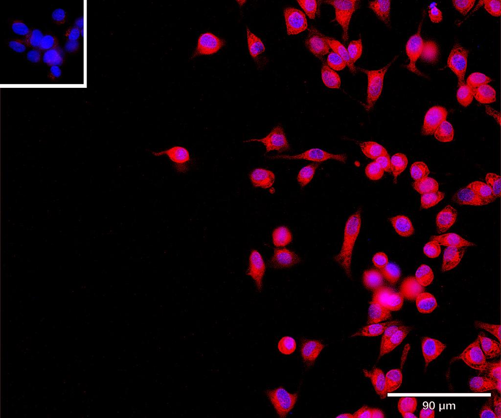 Ankyron PSG1_HUMAN Clone AL40107
