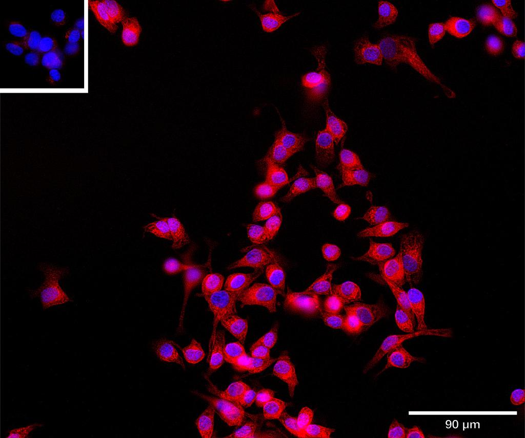 Ankyron PSG1_HUMAN Clone AL40109