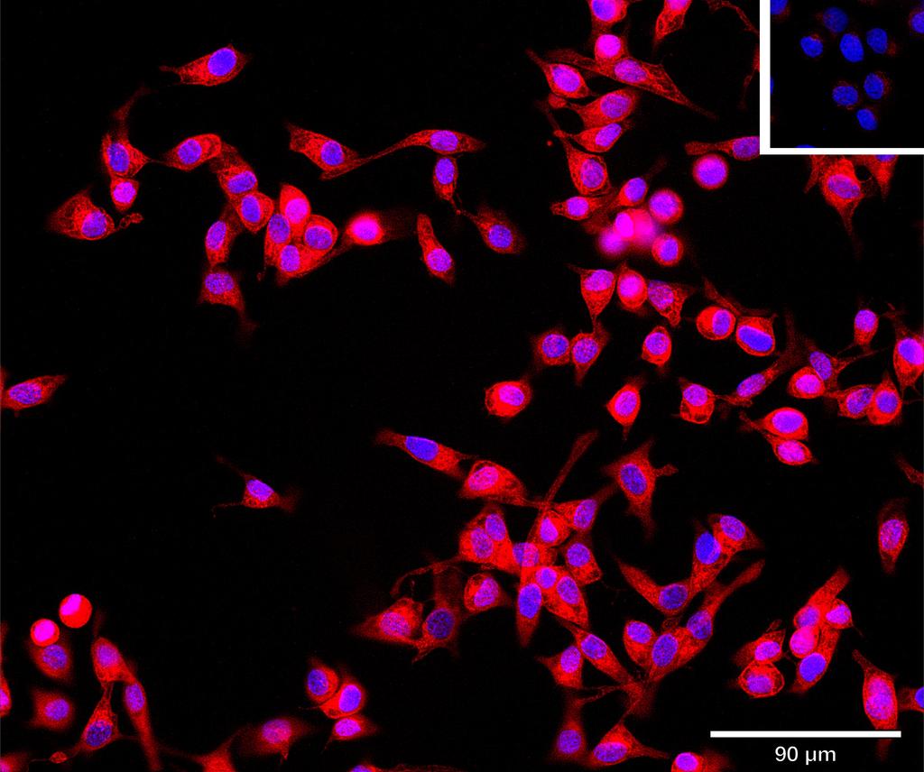 Ankyron PSG1_HUMAN Clone AL40117