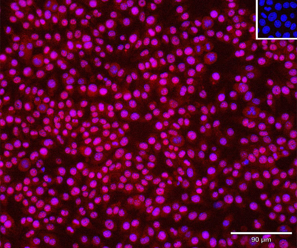Ankyron Q8R5L1_MOUSE Clone CT30973