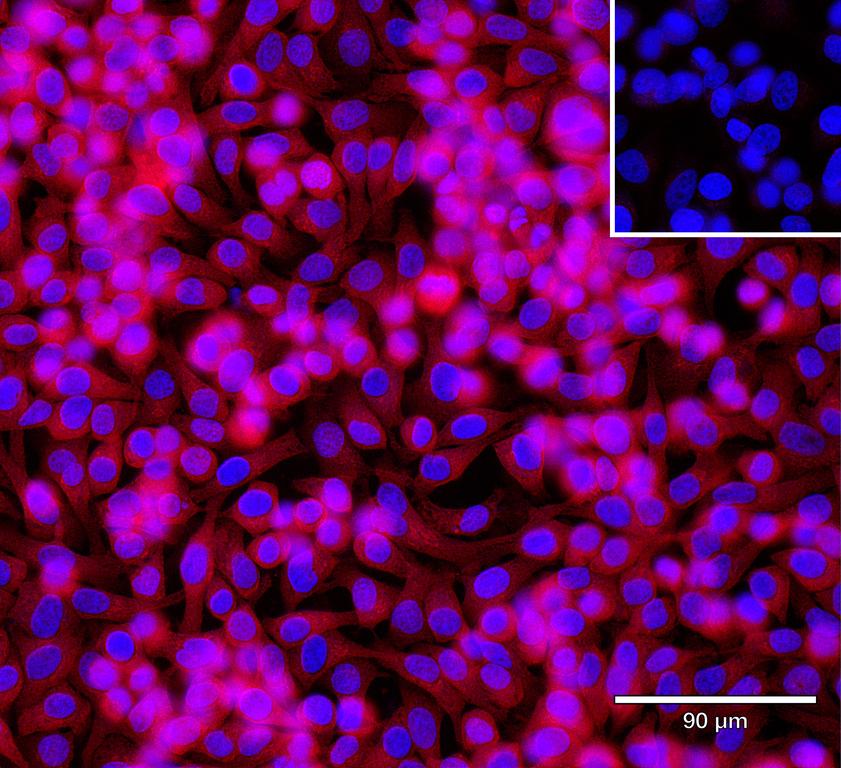 Ankyron RAB1B_HUMAN Clone DE40350