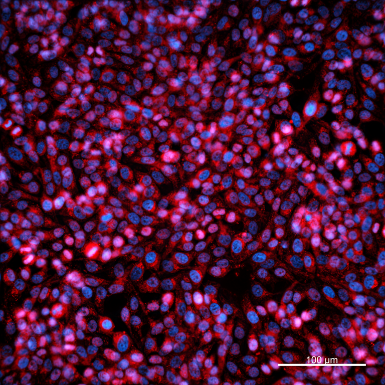 Ankyron RAF1_HUMAN Clone CO40701