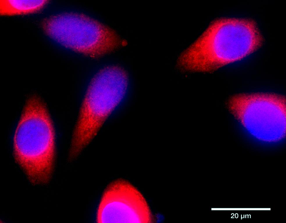 Ankyron RCAS1_HUMAN Clone BA40122