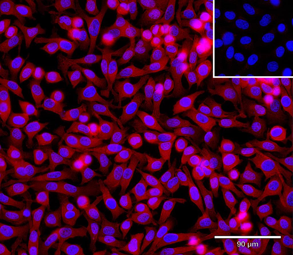 Ankyron RCAS1_HUMAN Clone BA40128