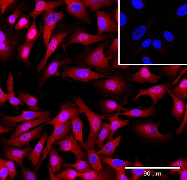 Ankyron RCN3_HUMAN Clone AR40290