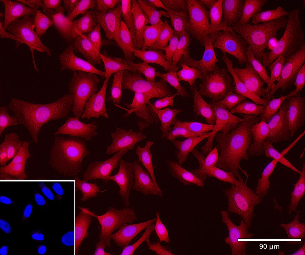 Ankyron RCN3_HUMAN Clone AR40292