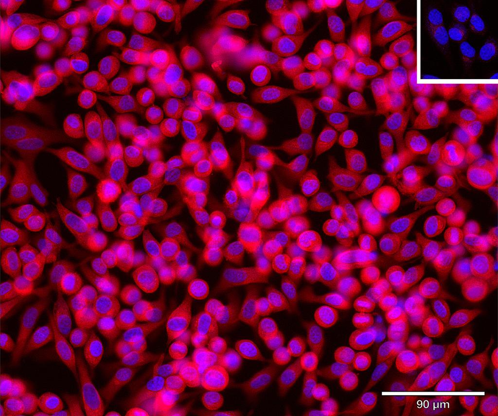 Ankyron RCN3_HUMAN Clone AR40281