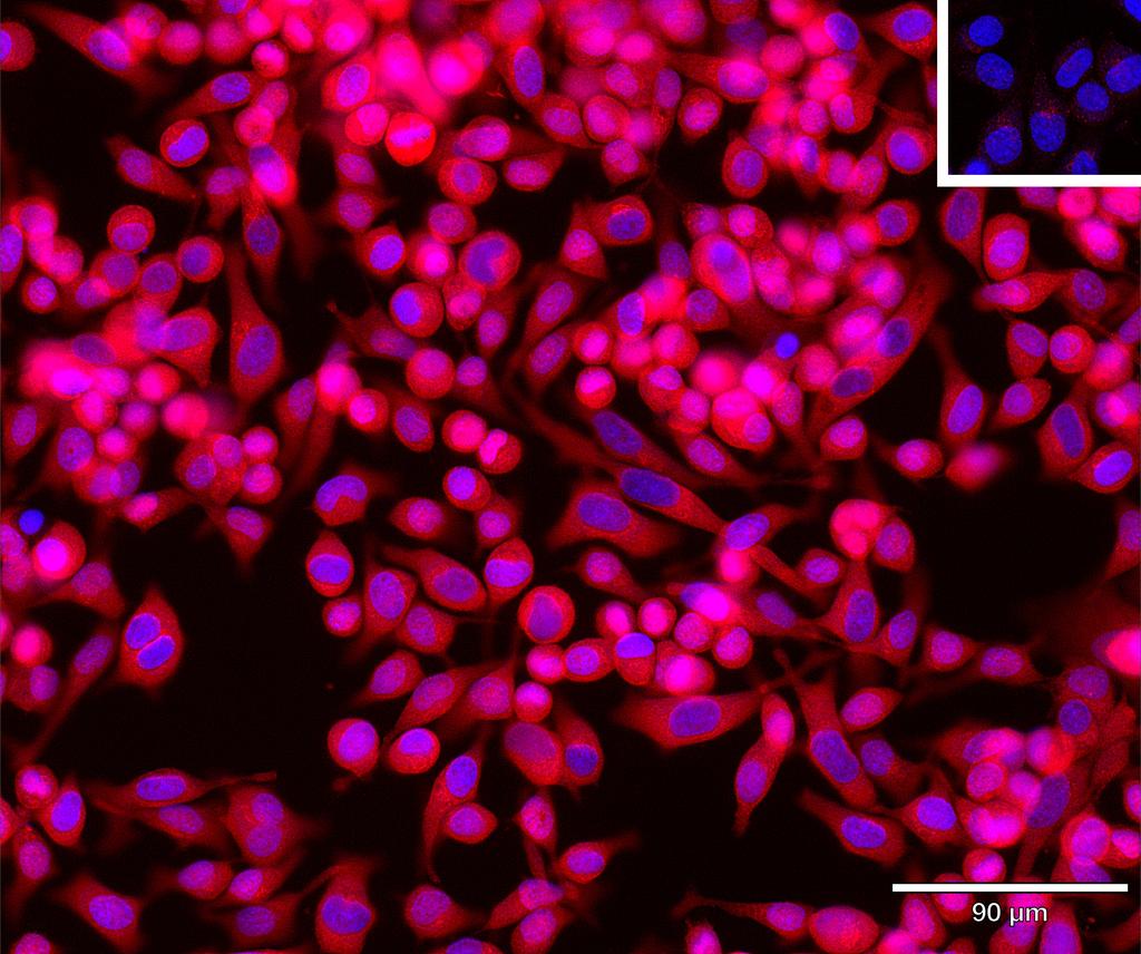 Ankyron RCN3_HUMAN Clone AR40287