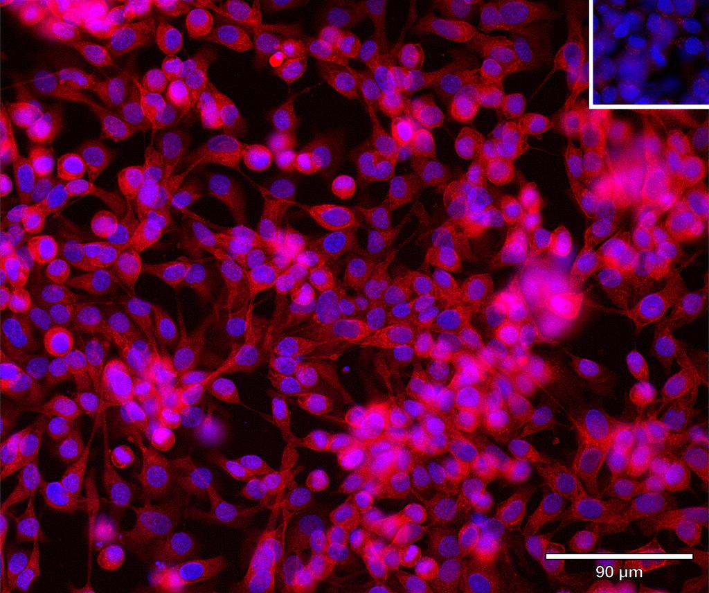 Ankyron RCN3_HUMAN Clone AR40282