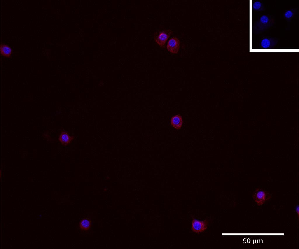 Ankyron RCN3_MOUSE Clone AM40190