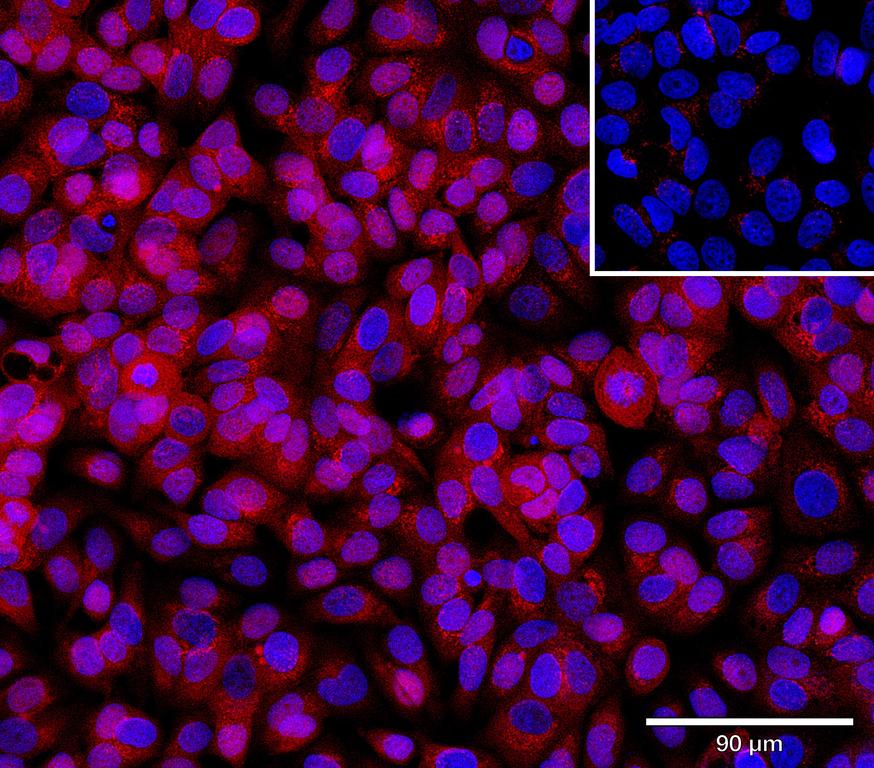 Ankyron REG3G_HUMAN Clone AW40814