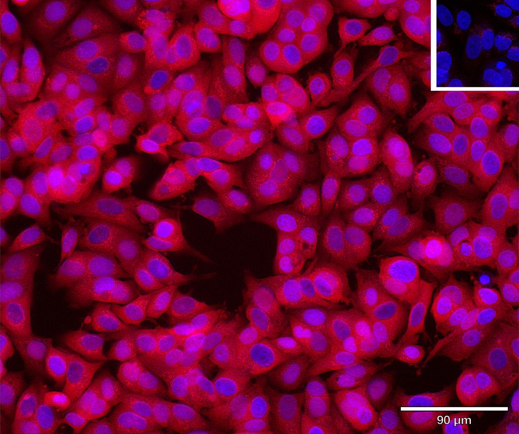 Ankyron REG3G_HUMAN Clone AW40815