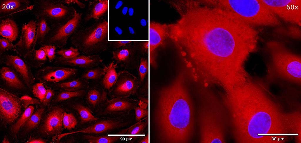 Ankyron ROBO4_HUMAN Clone AW40695