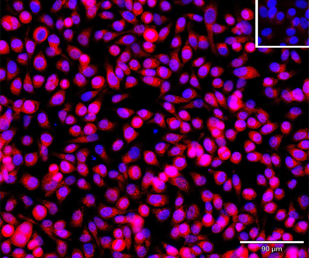 Ankyron S10A5_HUMAN Clone AU40156