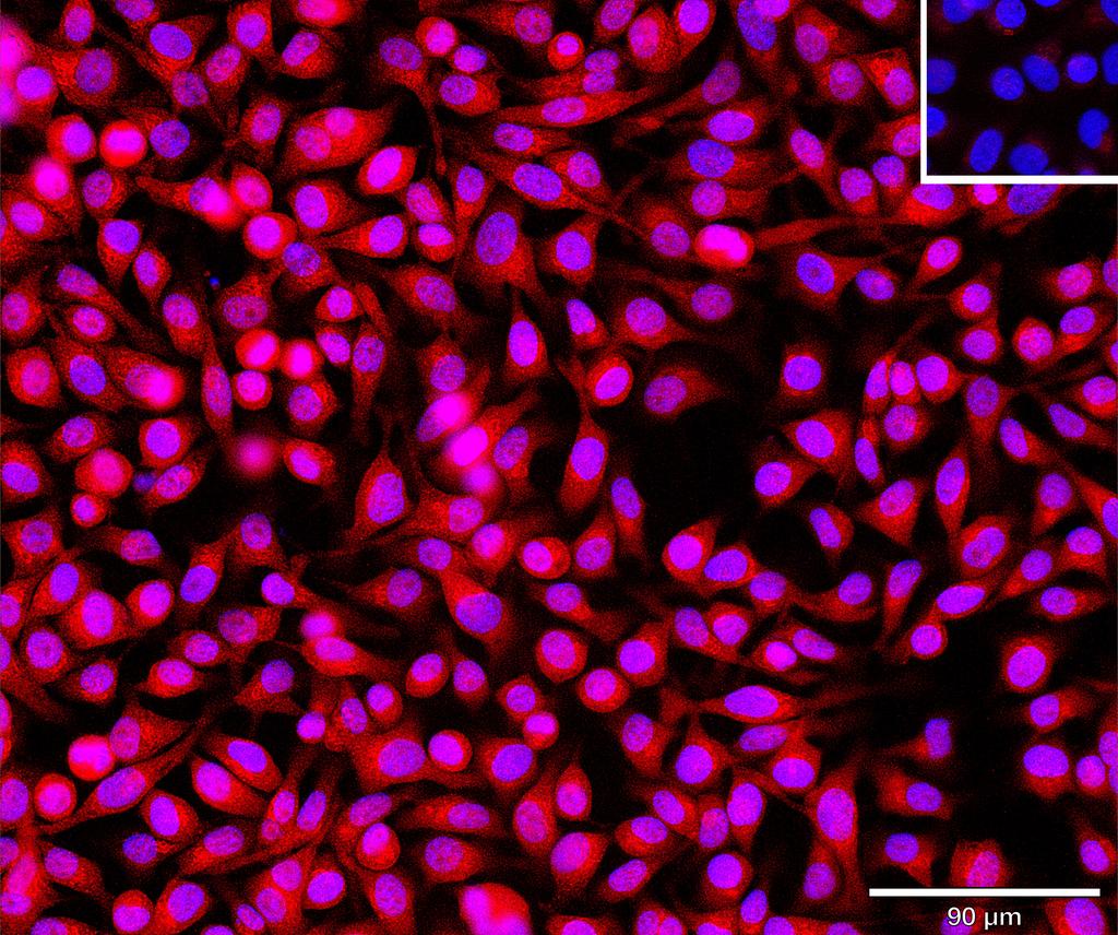 Ankyron S10A5_HUMAN Clone AU40157