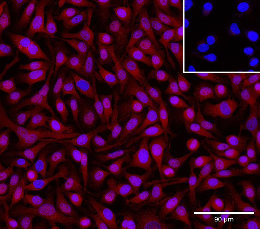Ankyron S10AB_HUMAN Clone DP40735