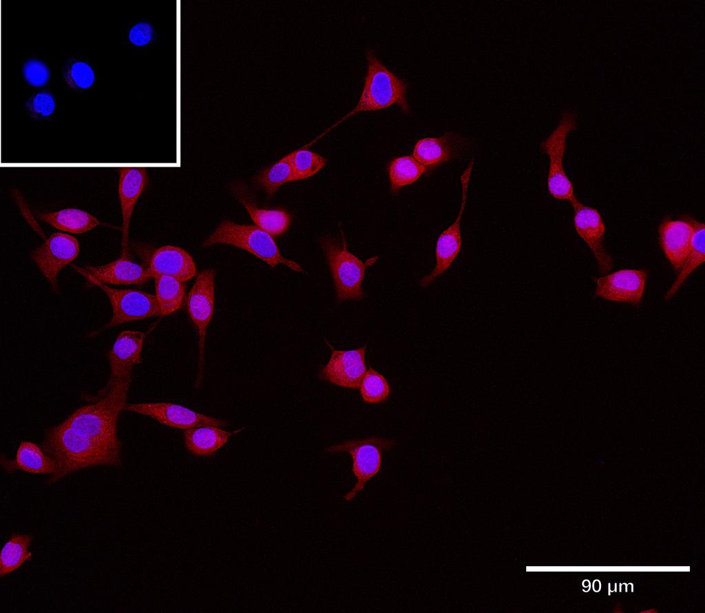 Ankyron S10AB_HUMAN Clone DC40633