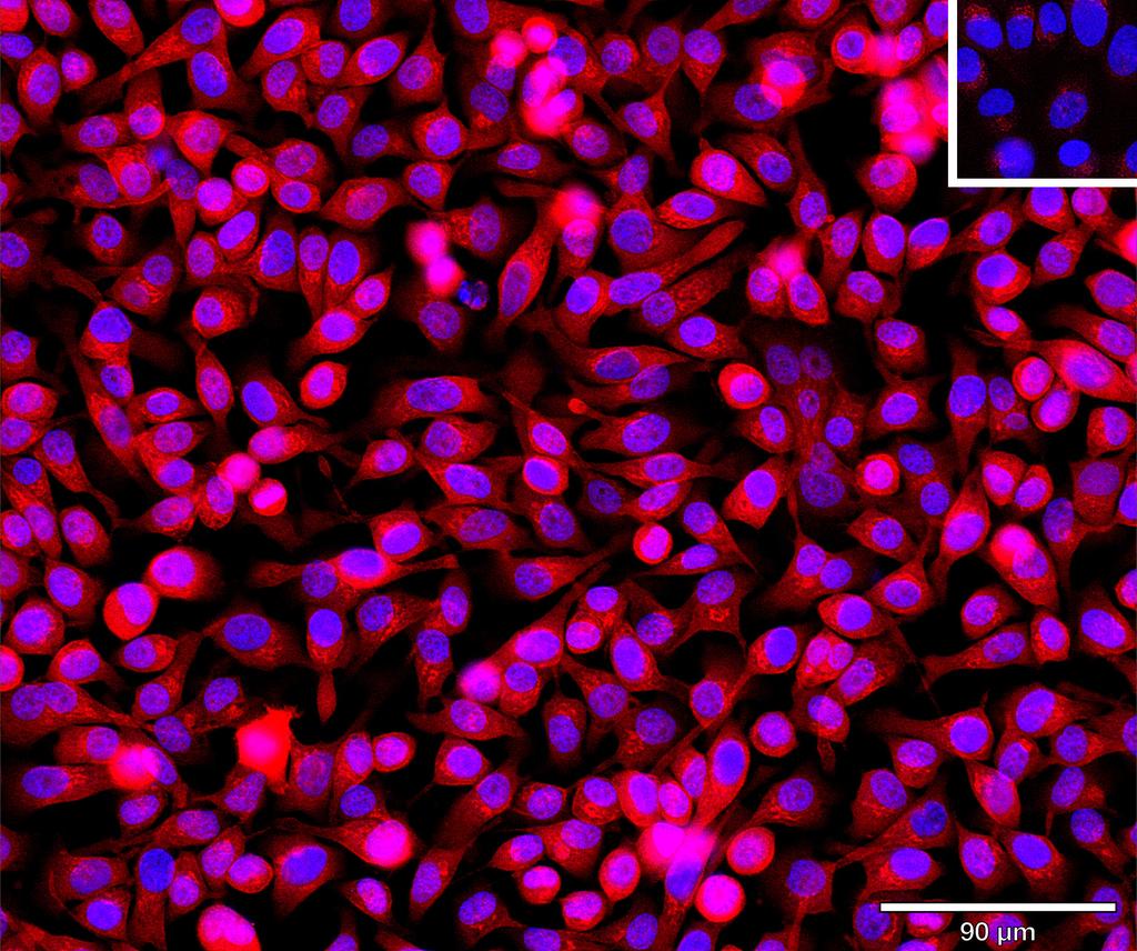 Ankyron SCF_HUMAN Clone BI40165