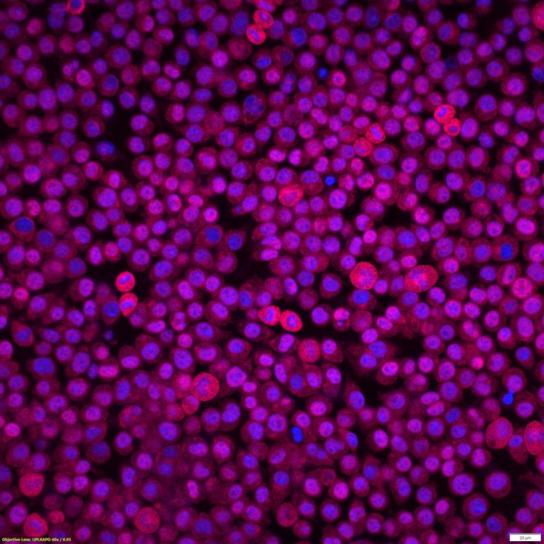 Ankyron SDC2_MOUSE Clone DI40538