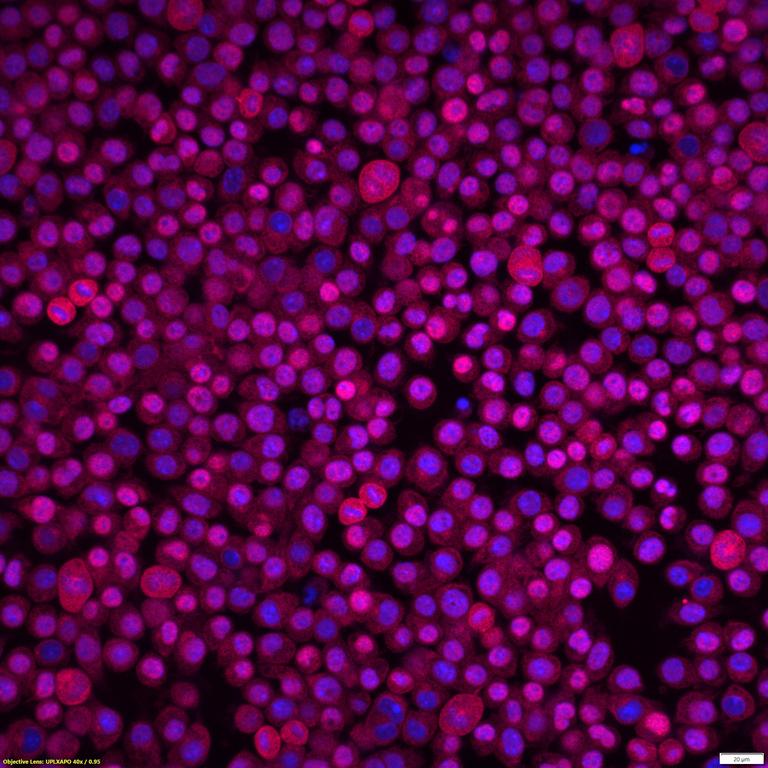 Ankyron SDC2_MOUSE Clone DI40539