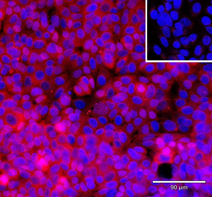 Ankyron SDCB1_HUMAN Clone AL40307