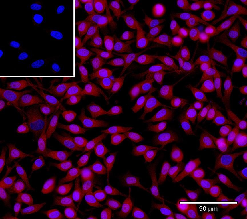 Ankyron SEM3A_HUMAN Clone DC40221