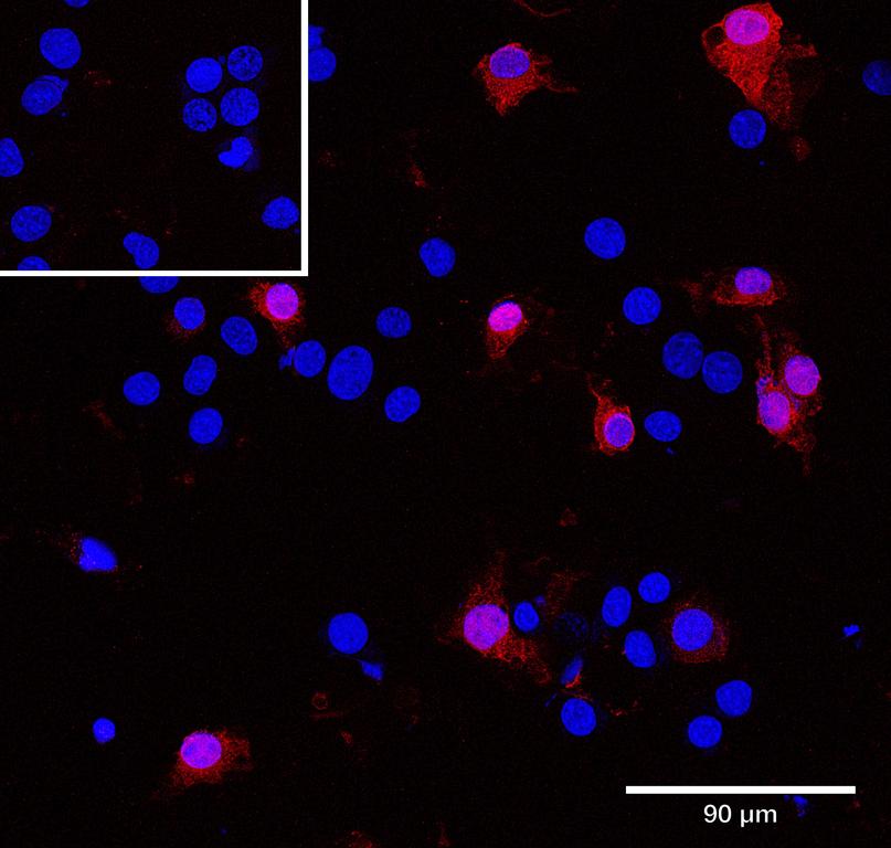 Ankyron SEM4D_MOUSE Clone AU40184