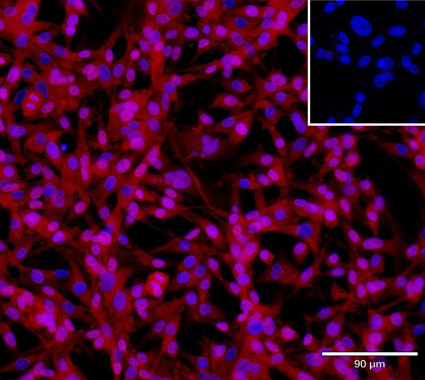Ankyron SEM5A_HUMAN Clone AZ40594