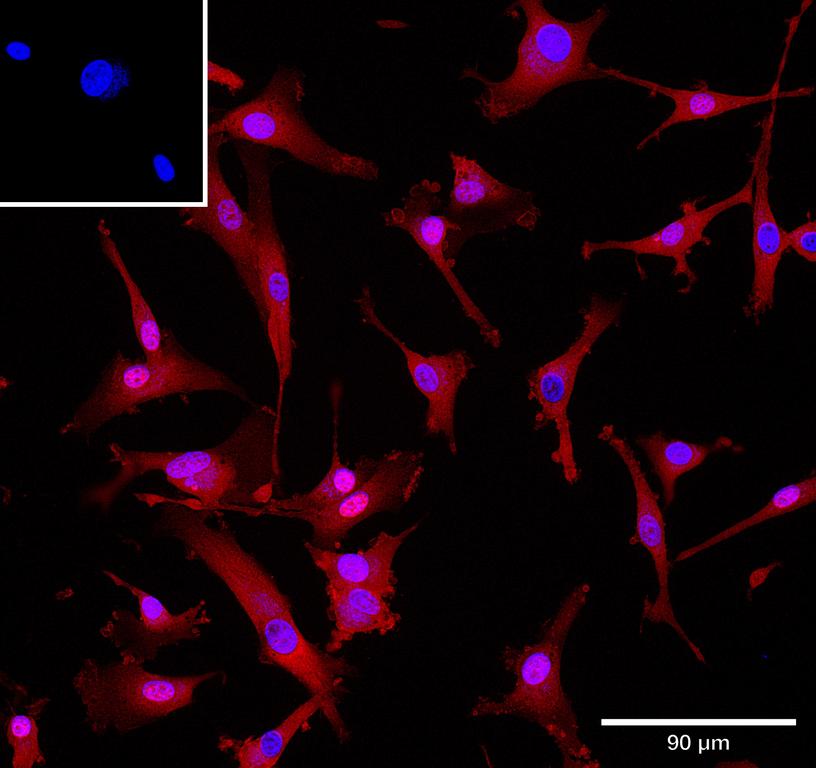 Ankyron SEM5A_HUMAN Clone AZ40590