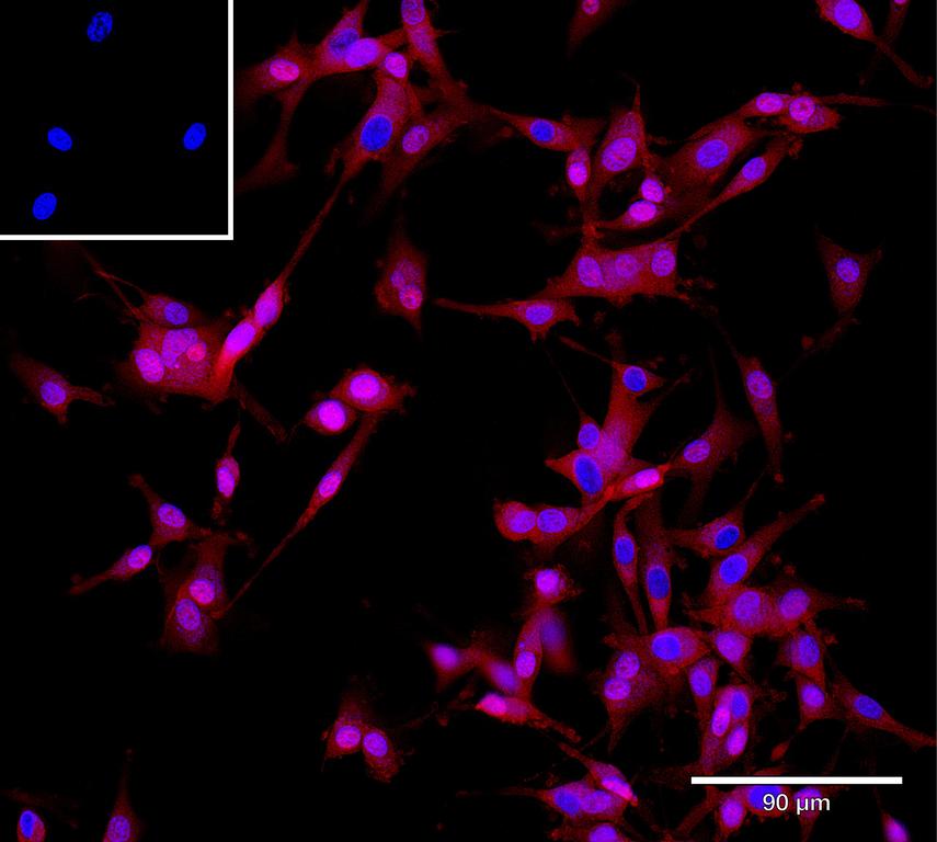 Ankyron SEM5A_HUMAN Clone AZ40591