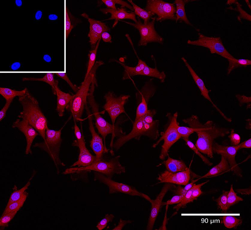 Ankyron SEM5A_HUMAN Clone AZ40592