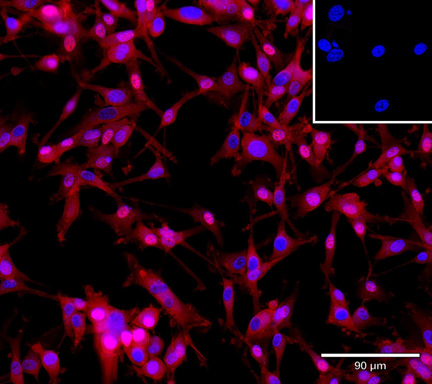 Ankyron SEM5A_HUMAN Clone AZ40595