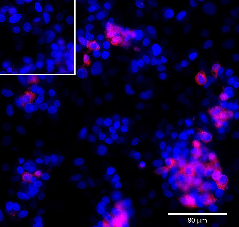 Ankyron SEM6A_HUMAN Clone AZ40554