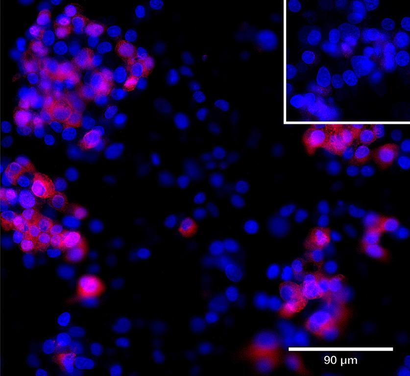 Ankyron SEM6A_HUMAN Clone AZ40555