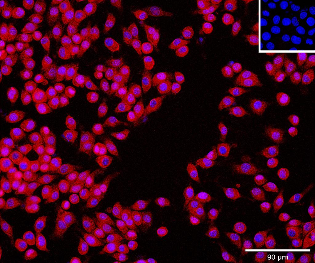 Ankyron SFRP2_MOUSE Clone AO40654