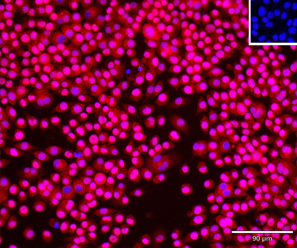Ankyron SFRP4_MOUSE Clone AZ41085
